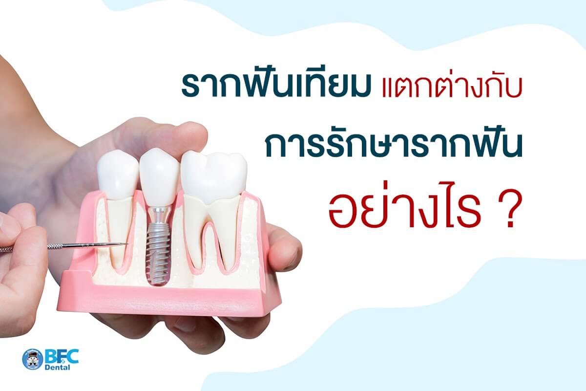 dental implant